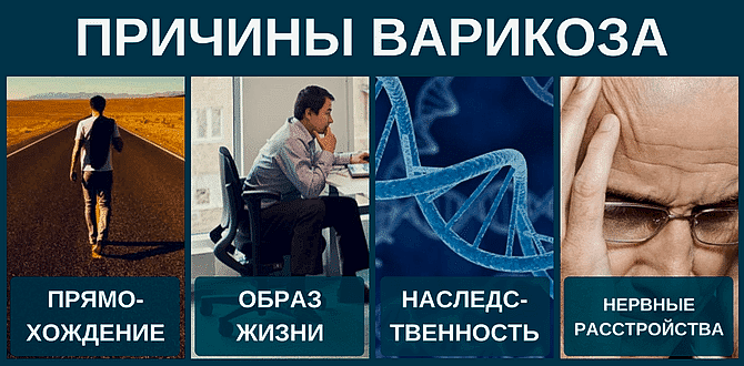 основные причины варикоза