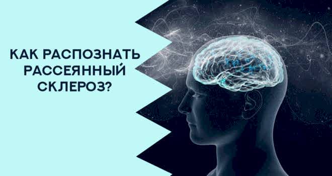 рассеянный склероз