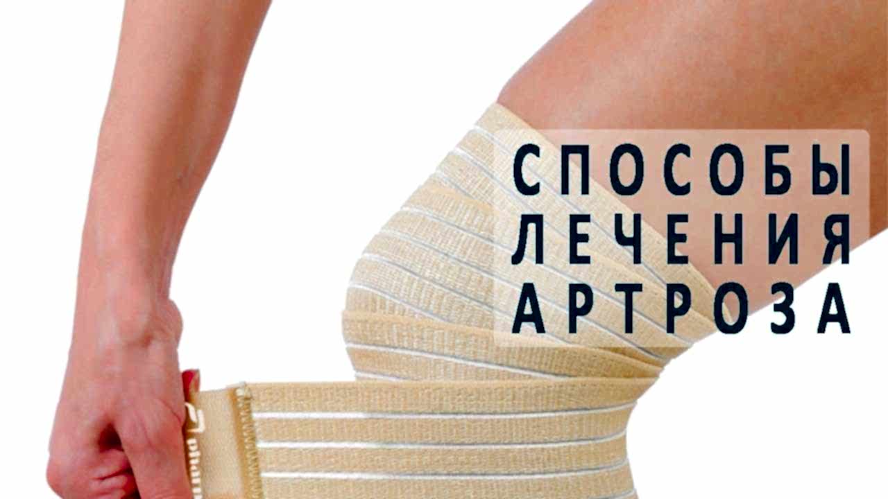 способы лечения артроза