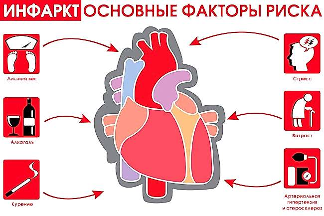 инфаркт
